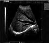 Ilustracja do pytania 11