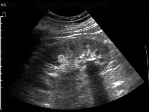 Ilustracja do pytania 4