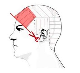 Ilustracja do pytania 9