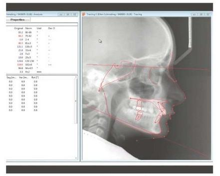 Ilustracja do pytania 36