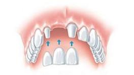 Ilustracja do pytania 36