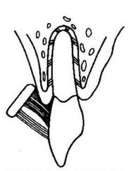 Ilustracja do pytania 40