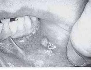 Ilustracja do pytania 5