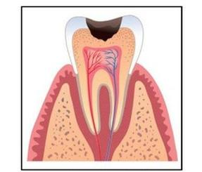 Ilustracja do pytania 26