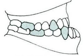 Ilustracja do pytania 14