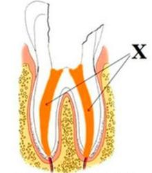 Ilustracja do pytania 20