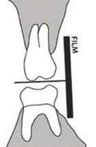 Ilustracja do pytania 4