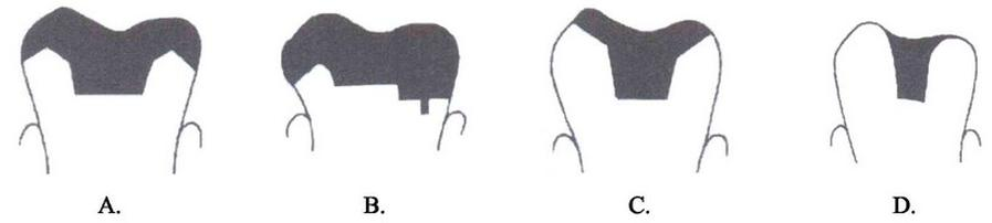 Ilustracja do pytania 23