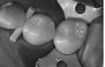 Ilustracja do pytania 25