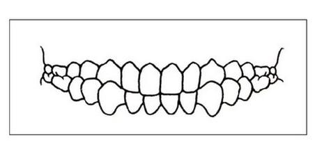 Ilustracja do pytania 2