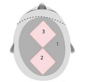 Ilustracja do pytania 36