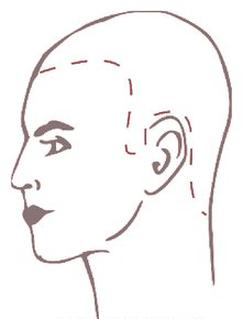 Ilustracja do pytania 17