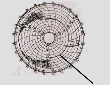 Ilustracja do pytania 22