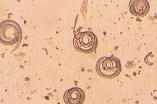 Ilustracja do pytania 36