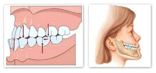 Ilustracja do pytania 19