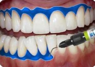 Ilustracja do pytania 26