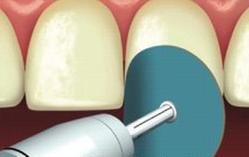 Ilustracja do pytania 13