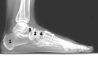 Ilustracja do pytania 25