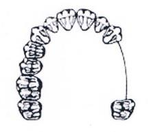 Ilustracja do odpowiedzi B