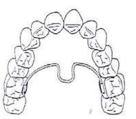 Ilustracja do odpowiedzi D