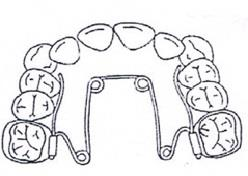 Ilustracja do odpowiedzi B