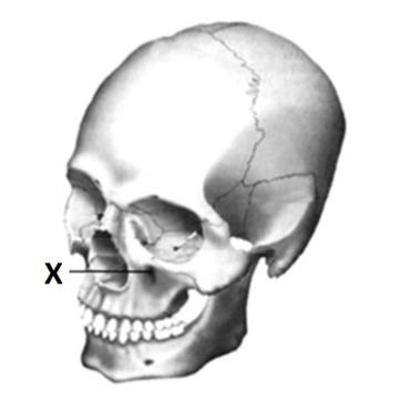 Ilustracja do pytania 18