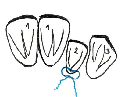 Ilustracja do pytania 17