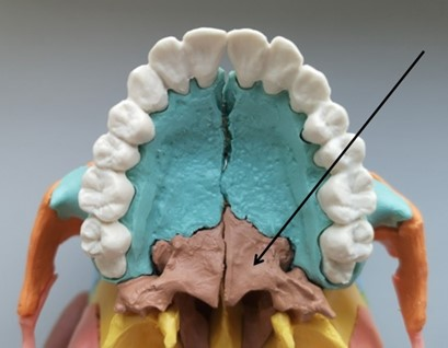 Ilustracja do pytania 6
