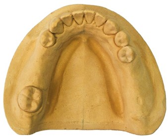 Ilustracja do pytania z kwalifikacji MED.06