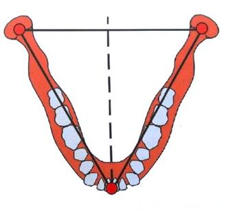 Ilustracja do pytania 5