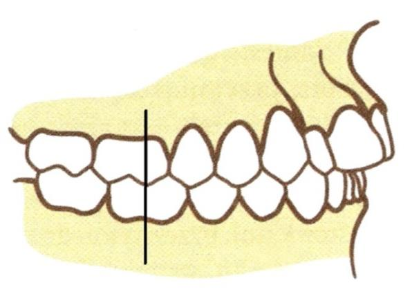 Ilustracja do pytania 36