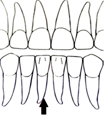 Ilustracja do pytania 2