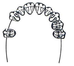 Ilustracja do odpowiedzi A