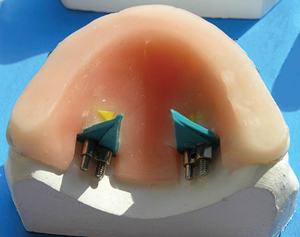 Ilustracja do pytania 30