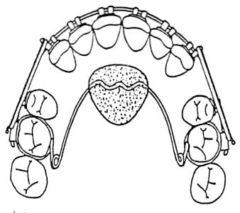 Ilustracja do odpowiedzi D