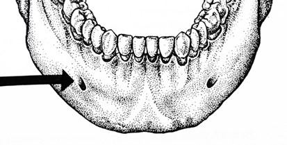 Ilustracja do pytania 25