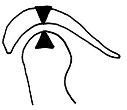 Ilustracja do odpowiedzi C