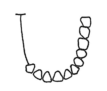 Ilustracja do odpowiedzi B