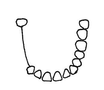 Ilustracja do odpowiedzi A