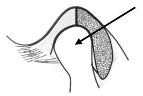Ilustracja do pytania 19