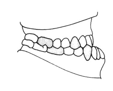 Ilustracja do odpowiedzi D