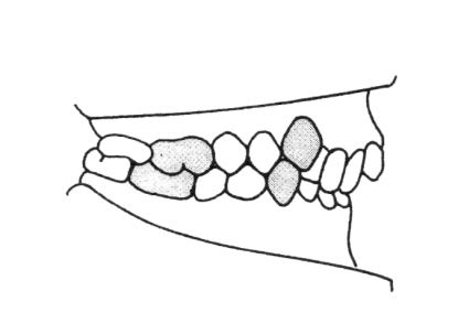 Ilustracja do odpowiedzi B