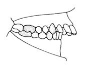 Ilustracja do odpowiedzi A