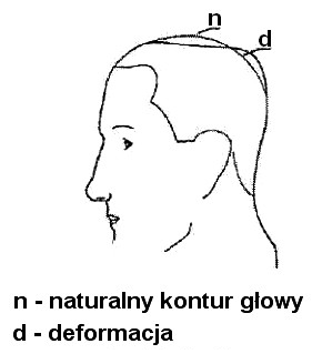 Ilustracja do pytania 7