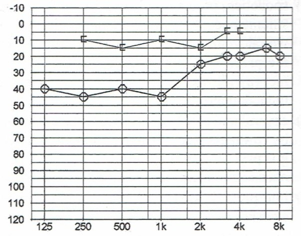 Ilustracja do pytania 36