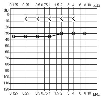 Ilustracja do odpowiedzi A