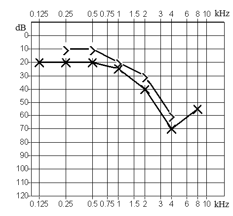 Ilustracja do odpowiedzi D