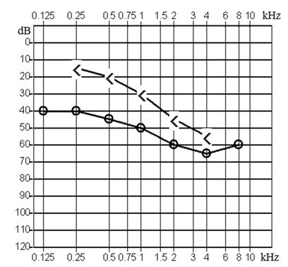 Ilustracja do odpowiedzi B