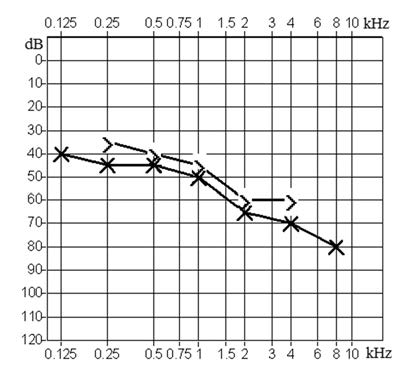 Ilustracja do odpowiedzi C