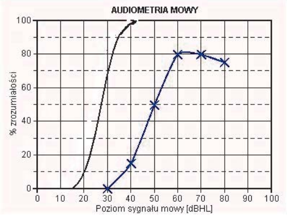 Ilustracja do pytania 5